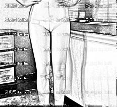 深圳希思医疗美容医院李瑞芳腿部吸脂介绍,末期我的总是变的漂亮，希望吧！