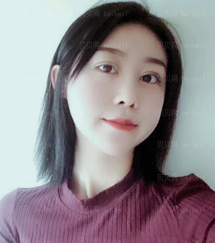 深圳阳光整形美容医院双眼皮+开眼角+膨体隆鼻介绍片较新分享——从侧面能够看的出来恢复的还是不错的,鼻尖和鼻翼的形状基本上都出来了,双
