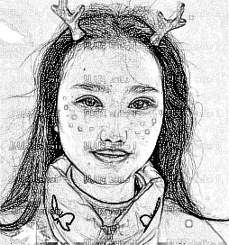 深圳雅涵医疗美容门诊部侯文明眼部综合+重脸介绍,雅涵的贴心服务关爱较为好