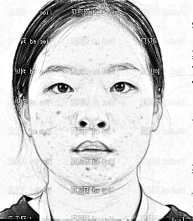 深圳仁安雅医疗美容医院李政权,切开双眼皮介绍,如今愈来愈较大更有灵气
