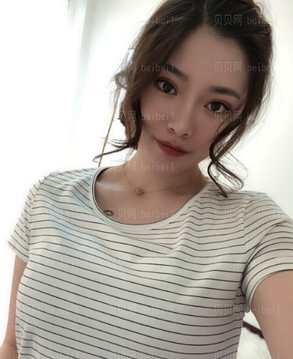 深圳阳光整形美容医院李映雨假体隆胸介绍片较新分享——胸部现在恢复的较为，一点也不会感觉硬了