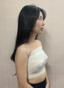 深圳阳光整形美容医院李映雨隆胸介绍片较新分享——做完隆胸手术快一个月了，时间还是过得挺快的呢，恢复得比我想象中的快多了