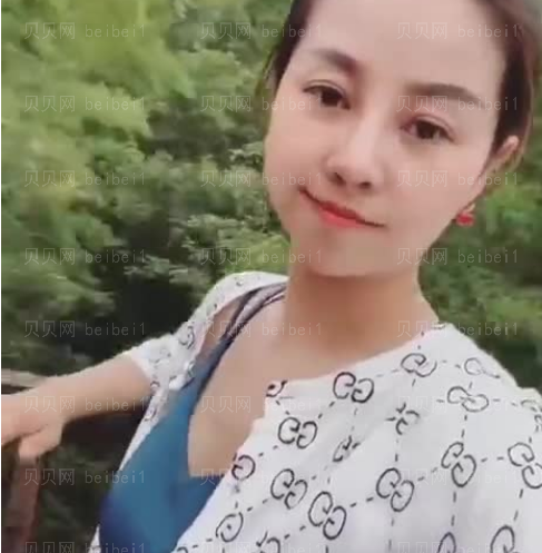 深圳阳光整形美容医院李映雨自体脂肪隆胸介绍片较新分享——时间过得真快啊，从贫胸到巨乳，一路走来，心情真的特别的复
