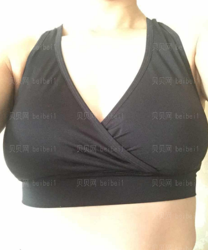 深圳阳光整形美容医院李映雨隆胸修复介绍片较新分享——胸部看起来也一点都不肿了,不穿内衣看上去较为的自然