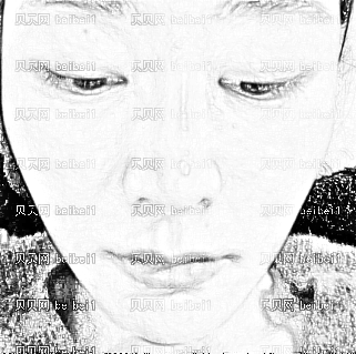 深圳仁安雅医疗美容医院李政权,假体隆鼻介绍,尽早见到彻底恢复好的模样