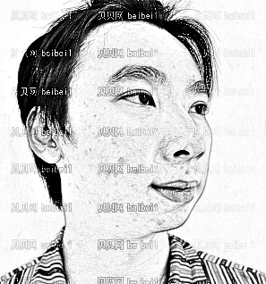 深圳千羽医疗美容整形医院王明辉,颧骨内推整形介绍,体会自已确实有长帅哦