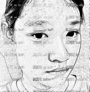 深圳千羽医疗美容整形医院王明辉,下颚角整形,只是整体化好许多了