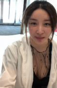 深圳阳光整形美容医院罗志敏假体隆鼻+假体垫下巴介绍片较新分享——感觉现在恢复的可好了，我特别的满意