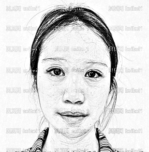 深圳鹏程医院周毅涛,玻尿酸丰眉弓介绍,就和脸型就很配搭了