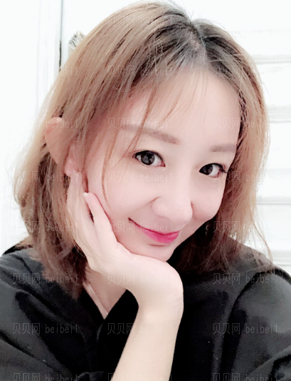 深圳阳光整形美容医院任义肋软骨隆鼻介绍片较新分享——做完隆鼻手术正好百天了，已经恢复的很好了