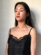 深圳阳光整形美容医院万晓楠自体脂肪隆胸介绍片较新分享——恢复的还是挺不错的，现在的胸部摸上去较为柔软，较为自然