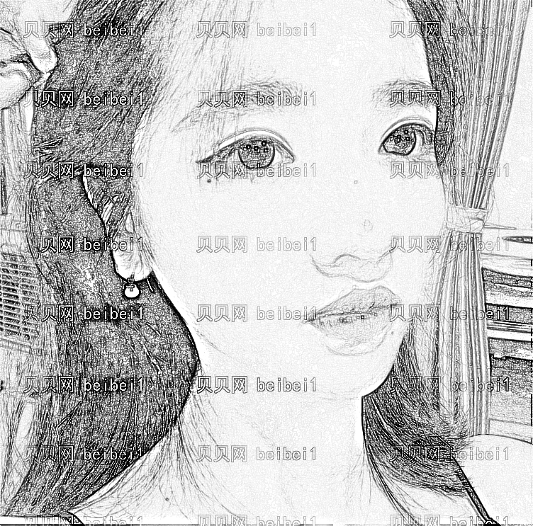 山东中医药大学第二附属医院整形美容外科王吉昌面部吸脂1-3个月术后恢复~
