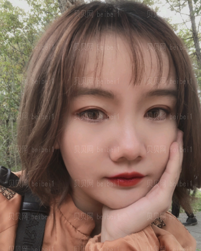 深圳阳光整形美容医院邹进进双眼皮+开眼角介绍片较新分享——自从有了双眼皮之后,随随便便撸个妆都感觉自己美爆了,现在的我比以前可自信多了