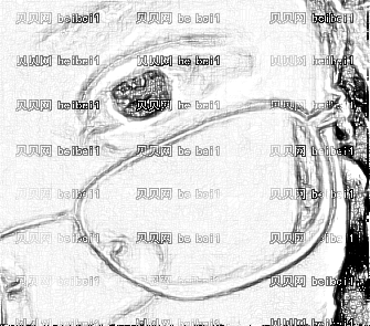 四川华美紫馨医学美容医院艾玉峰双眼皮介绍片较新分享_目前就等恢复正常吧。