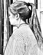 四川美莱整形美容医院郭晓进双眼皮介绍片较新分享_也能像我壹样拥有水汪汪的大眼睛哦。
