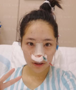 深圳源美医疗美容门诊部吴晓玲隆鼻修复案例图片最新分享——今天的总体感觉还不错，脸基本不肿了，嗓子也没有之前那么疼了