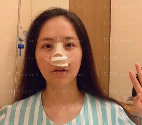 深圳源美医疗美容门诊部吴晓玲隆鼻修复案例图片较新分享——今天的总体感觉还不错，脸基本不肿了，嗓子也没有之前那么疼了