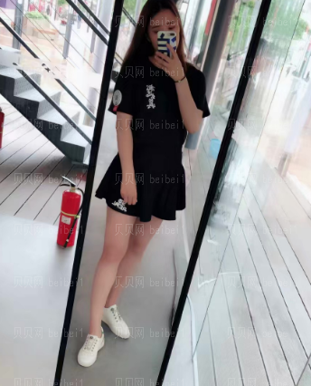 深圳臻瑞芝美医疗美容门诊部潘铁军全身吸脂介绍片较新分享——腿上的淤青已经差不多消完了,肿胀也基本都没有了