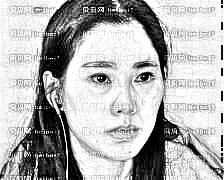 四川美莱整形美容医院熊猛全切双眼皮介绍分享