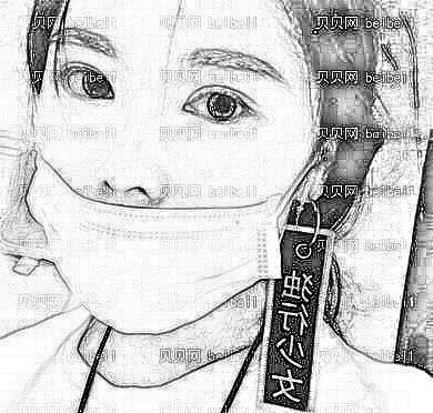 四川华人医联_马丽医生_全切双眼皮+开内眼角+上睑提肌介绍分享!