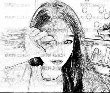 四川友谊_罗恩医生_硅胶垫下巴_术后介绍分享!早做早美丽~