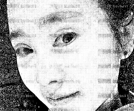 成都军大_张家龙医生_全切双眼皮介绍分享~