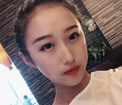 广州韩妃医学美容医院 牟北平医生 假体隆鼻介绍分享