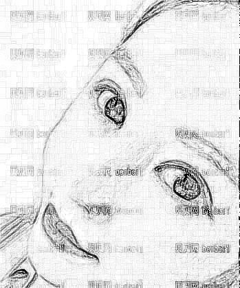 四川悦好_陈国双医生_肋软骨隆鼻+鼻翼缩小_术后介绍分享~
