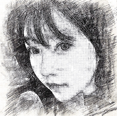 四川悦好_胡纯兵医生_假体垫眉弓_术后介绍分享~