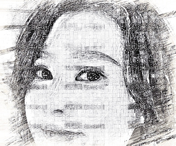 四川悦好_胡纯兵医生_耳软骨隆鼻+鼻小柱延长_术后介绍分享~
