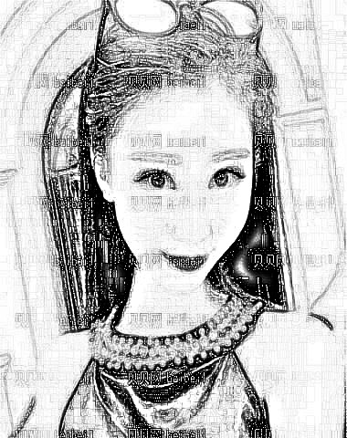 成都军大_雷子陵医生_面部填充+面部吸脂_术后介绍分享~