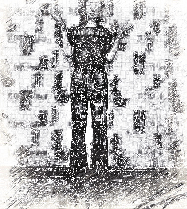 成都军大_刘宏伟医生_吸脂瘦大腿_术后介绍分享~