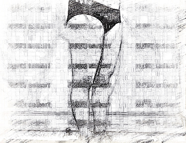 成都军大_蒲小兵医生_腹部吸脂+大腿吸脂_术后介绍分享~