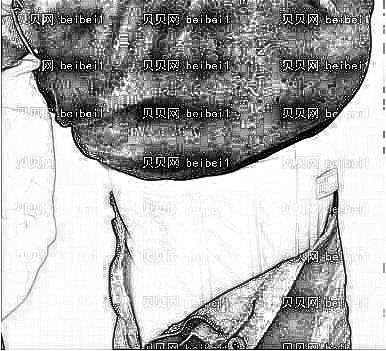 成都军大_孙延辉医生_腰腹吸脂_术后介绍分享！
