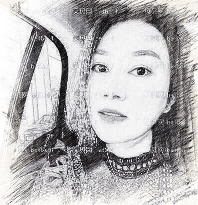 广州广美_王加凌医生_埋线提升_术后介绍分享~