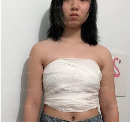 广州市荔湾区人民医院整形美容科,齐云香丰胸介绍,感觉现在更接近于真正的胸部感觉。
