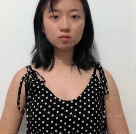 广州市荔湾区人民医院整形美容科,齐云香丰胸介绍,感觉现在更接近于真正的胸部感觉。