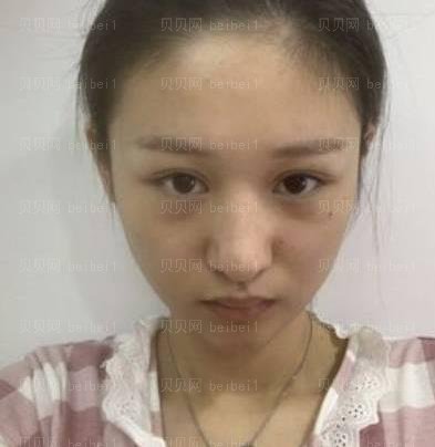 广州市荔湾区人民医院整形美容科,齐云香隆鼻介绍,五官有特色有亮点，发型，衣着怎么换都好看。