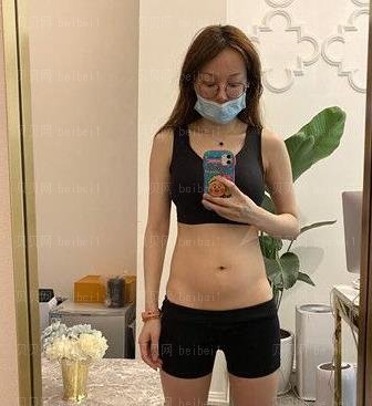广州南方医院整形美容外科,冯传波腰腹部吸脂介绍,如今穿衣服成确实好，穿衣风格平行线升高，