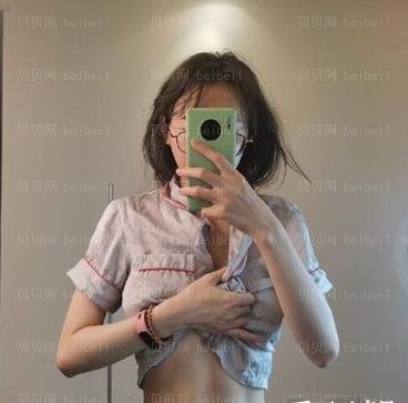 广州南方医院整形美容外科,冯传波腰腹部吸脂介绍,如今穿衣服成确实好，穿衣风格平行线升高，