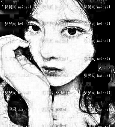 广州南方医院整形美容外科,姜平鼻部修复介绍,我现在恢复得很好！看看照片就知道嘿嘿