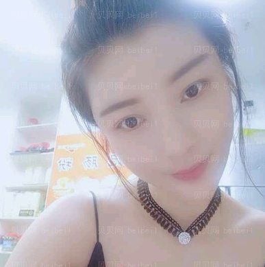 广州韩妃医学美容医院 于洪瑞医生 自体脂肪面部填充介绍分享