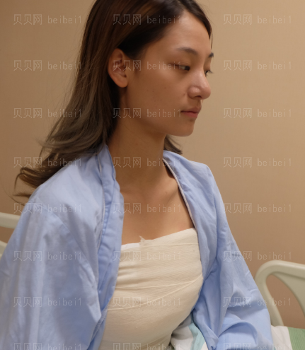 广州韩妃医学美容医院 于洪瑞医生 假体隆胸介绍分享
