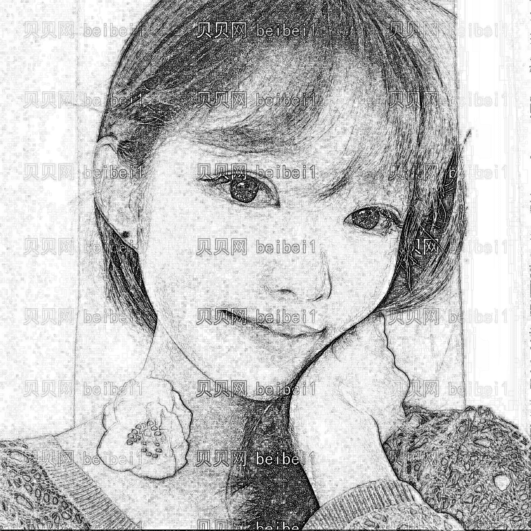 成都军大_沈燕华医生_肋软骨隆鼻+驼峰鼻矫正_术后分享~
