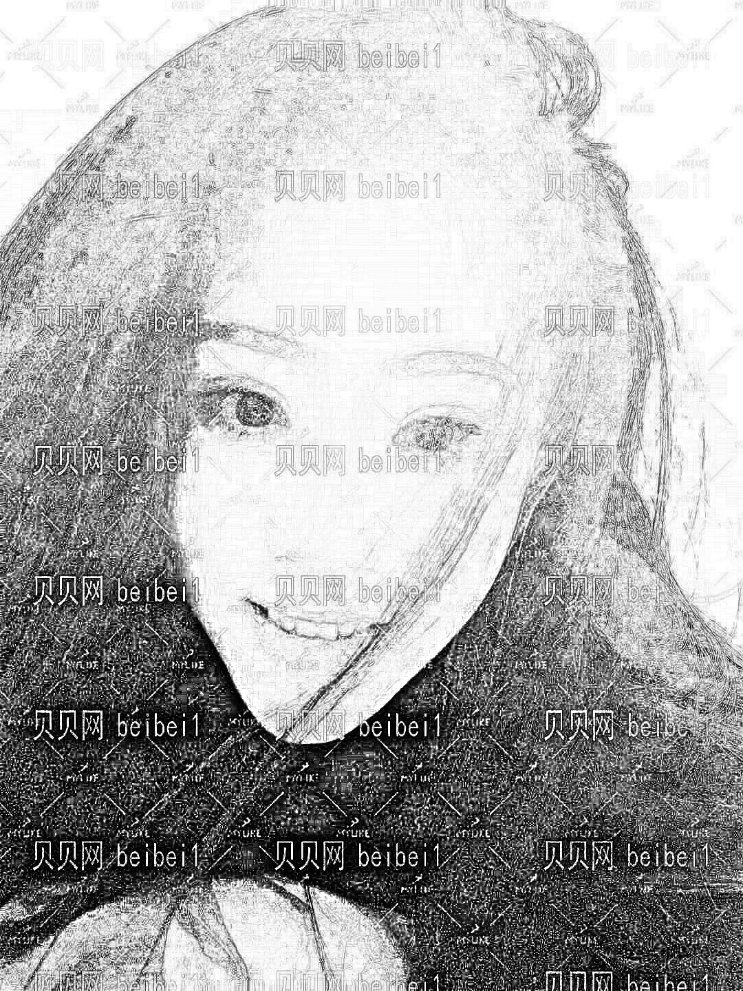 广州缔妍_于海成医生_膨体隆鼻_术后分享~