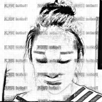 广州鹏爱医疗美容门诊部,黄文亭,鼻部综合隆鼻介绍,真得谢谢黄文亭医生，给我做了这么好的鼻部，