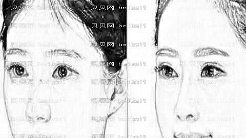 郑州缔莱美双眼皮修复大概多少钱？双眼皮修复