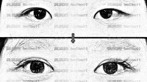 郑州东方整形割双眼皮医生排名,哪个医生性价比高？做的自然？