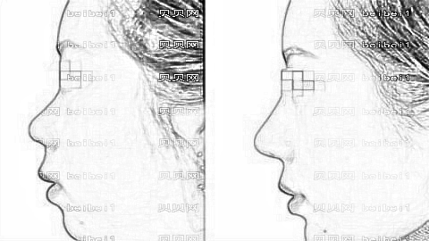 保定蓝山杜建龙隆鼻做的怎么样?价格贵吗?介绍