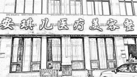 郑州安琪儿抽脂果好不好？哪个医生吸脂技术靠谱？